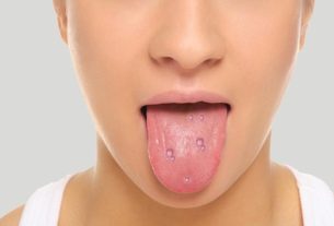 If you have are troubled with Mouth blisters, use home remedies